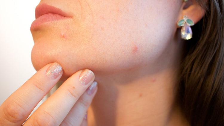 Oily & Acne Prone Skin